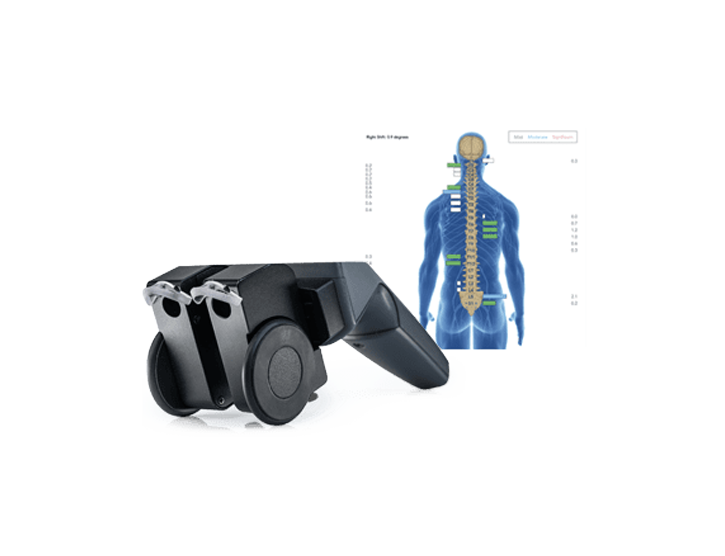 INSiGHT neuroTHERMAL rolling scanner beside a spine graphic showing readings at each spinal level